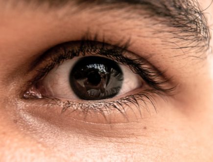 5 redenen waarom je een ooglidcorrectie moet overwegen