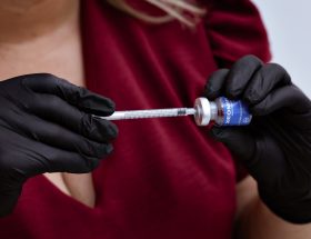 Natuurlijk resultaat met fillers: mythe of werkelijkheid?